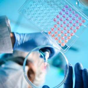 Eine Hand h&auml;lt eine Pipette und f&uuml;llt eine Fl&uuml;ssigkeit in eine Petrischale.