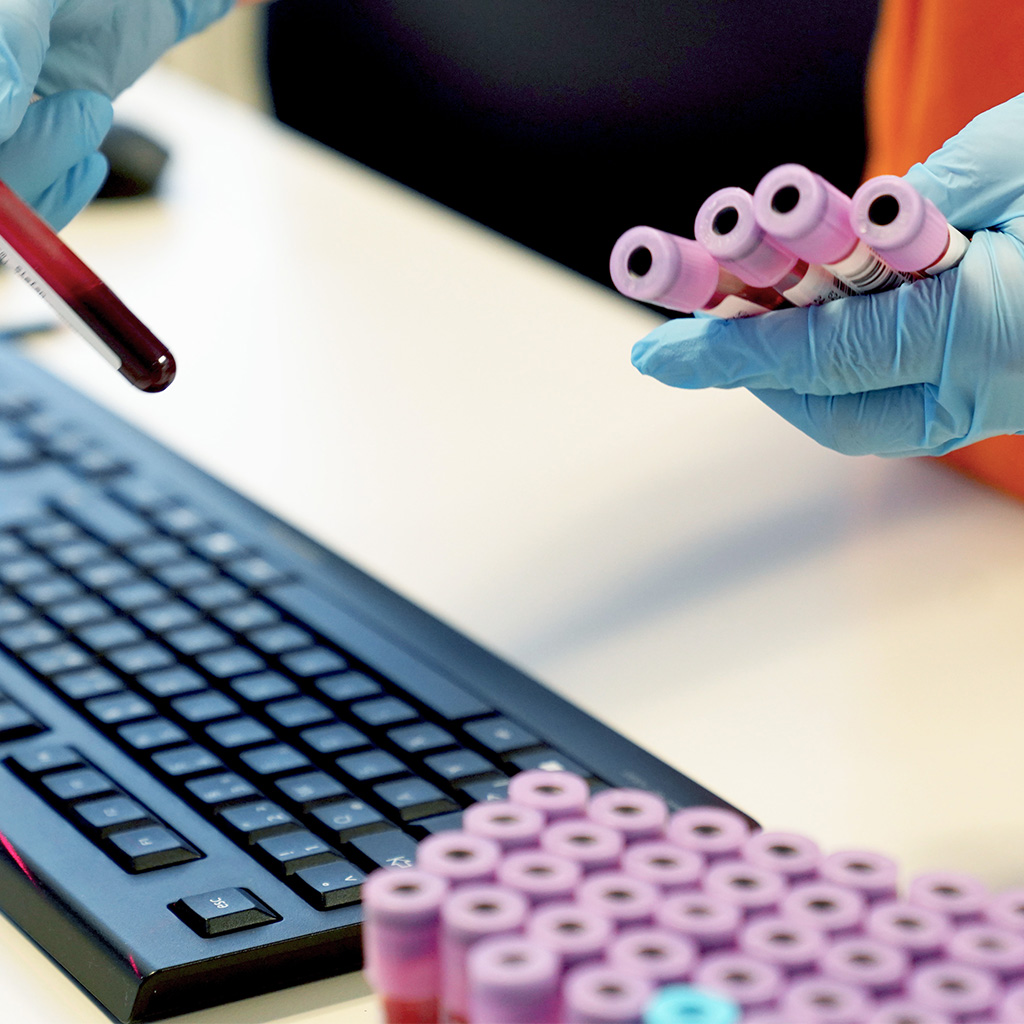 Das Bild zeigt Blutproben, die im Labor des Onkologischen Zentrums am Klinikum Mittelbaden analysiert werden.