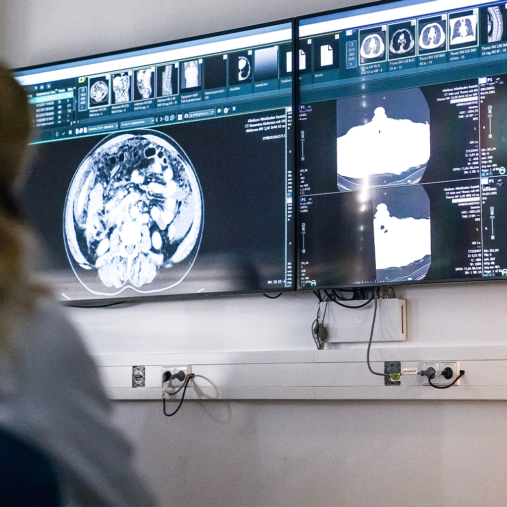 Das Bild zeigt MRT-Bilder, die im Rahmens eines Tumorboards des Onkologischen Zentrums am Klinikum Mittelbaden besprochen werden. die Teilnehmer eines Tumorboards des Onkologischen Zentrums am Klinikum Mittelbaden.